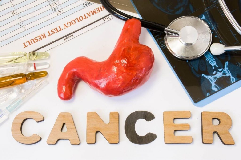Todo sobre el cancer gastrico