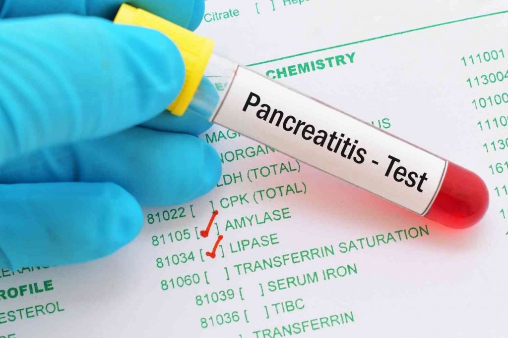 Factores de riesgo familiares en el cancer de pancreas
