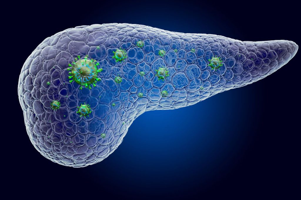 cancer de pancreas CDMX